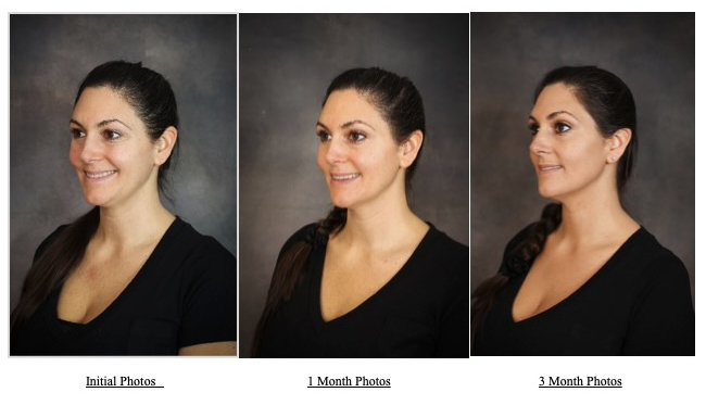 before and after using 3lemental tools