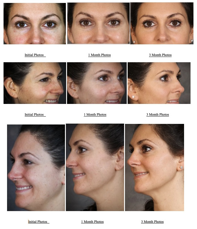 before and after using 3lemental tools