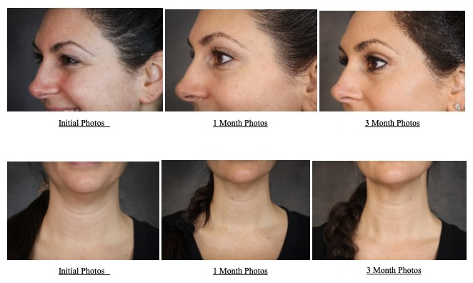 before and after using 3lemental tools